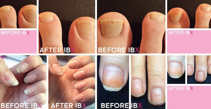 IBX: The Solution to Damaged Nails - Nest Nail Wellness Spa